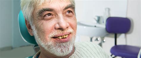 Yellow teeth: Causes and treatment | CURAPROX