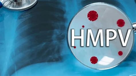 HMPV FAQs: Expert Answers to Common Questions About Human ...