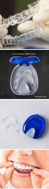 Orthodontics - Braces || Dr.Vakharia | Dental Care