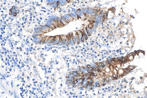 Cytokeratin 20 antibody (82428-1-RR) | Proteintech