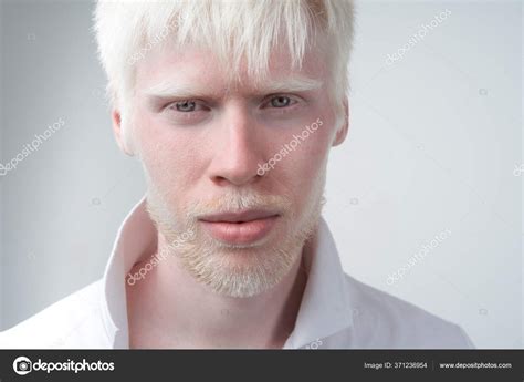 White Albino People