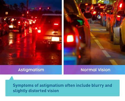 Car Lights Astigmatism Vs Normal at Walter Belin blog