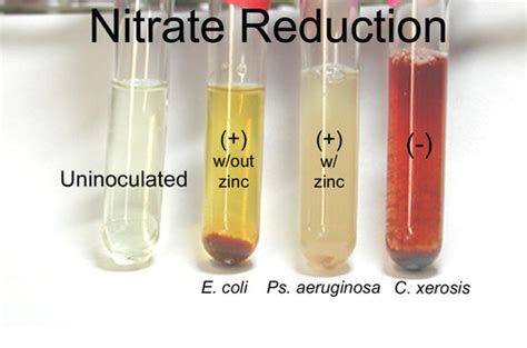 Image result for Positive Nitrate Test