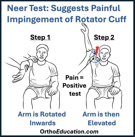 Rotator Cuff Tendonitis - Shoulder Education