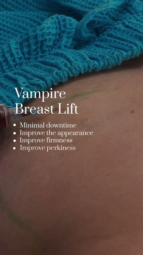 What Is A Vampire Breast Lift? - YouTube