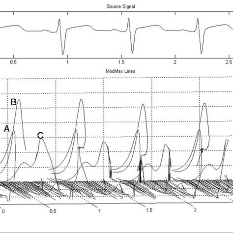 Image result for Beat Detection Algorithm