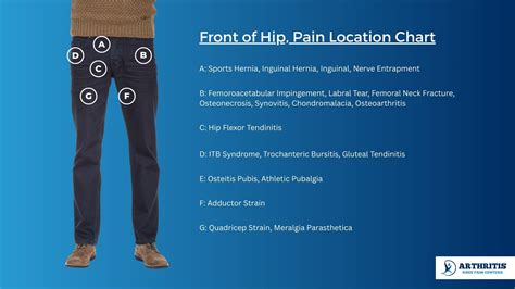 Hip Pain Location Chart: Quick Guide