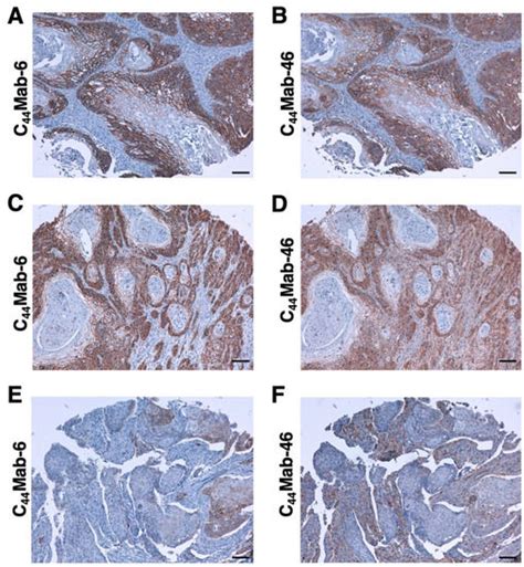 A Novel Anti-CD44 Variant 3 Monoclonal Antibody C44Mab-6 Was ...