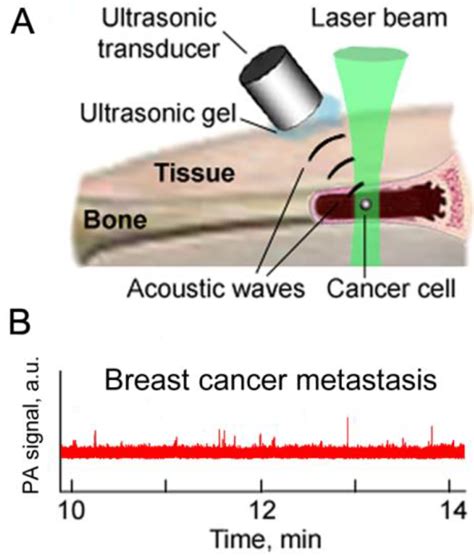 Circulating Tumor Cell Detection and Capture by Photoacoustic Flow ...