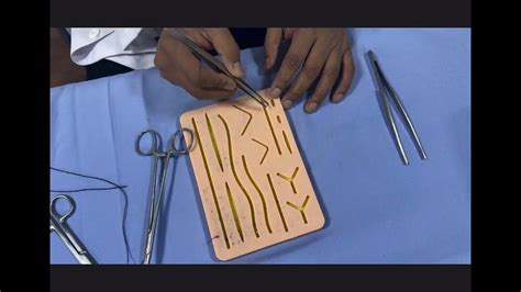 Basic Interrupted Suture 的图像结果