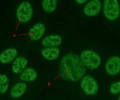 Image result for Homogeneous Pattern