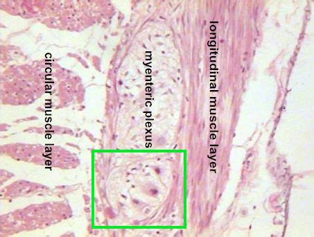 Image result for Jejunum Microscope
