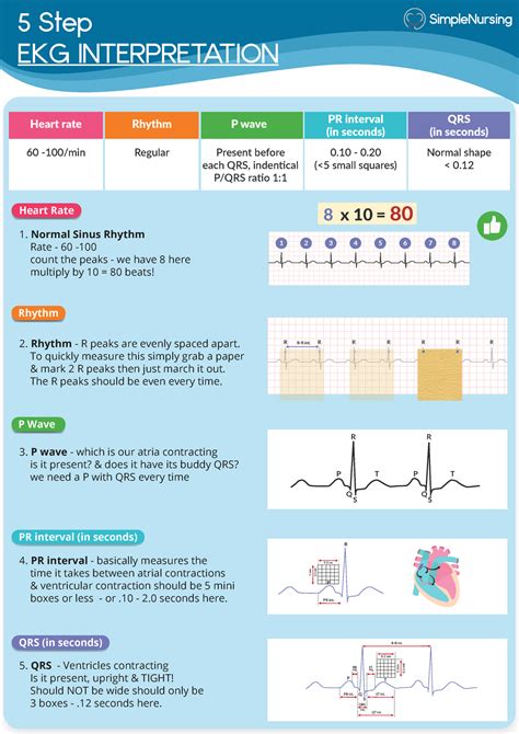 1 5 step ekg interpretation 5 step ekg interpretation heart rate rhythm p wave pr interval in ...