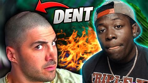 Headset Making Dent In Head at Indiana Brownless blog