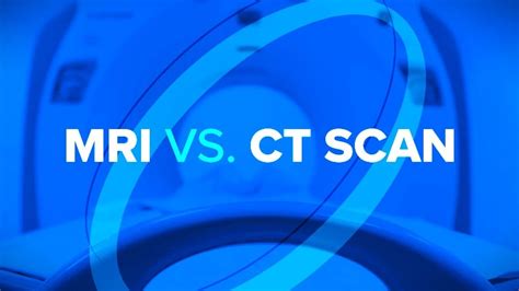 MRI vs CT Scan: MRI और सीटी स्कैन के बीच अंतर