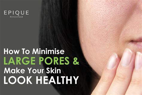 Here’s How to Minimise Large Pores and Make your Skin Look Healthy – MyEpique.in