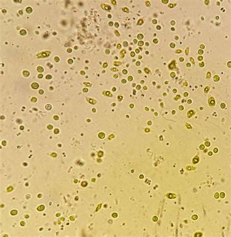 Image result for microalgae