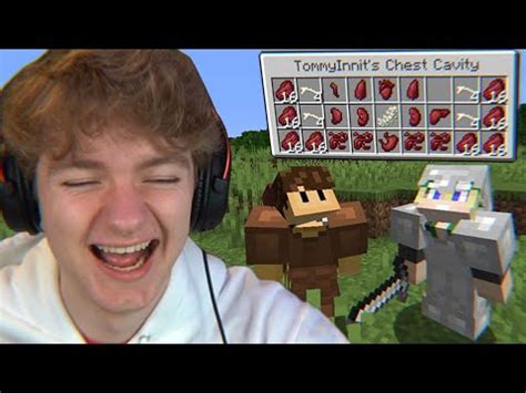 Image result for Minecraft Surgery Mod Gameplay