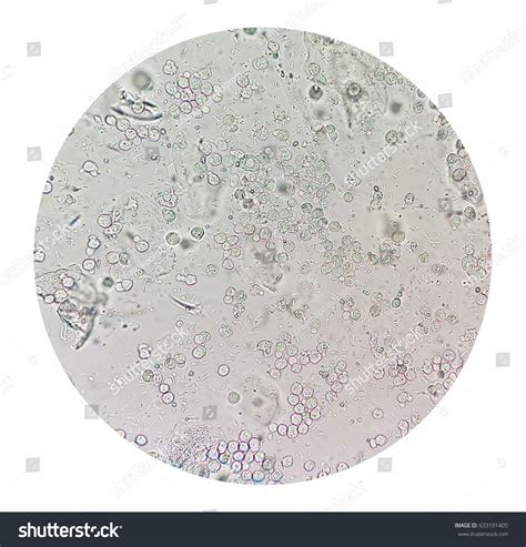 Bacteria In Microscopic Urinalysis at Jeremy Tellez blog