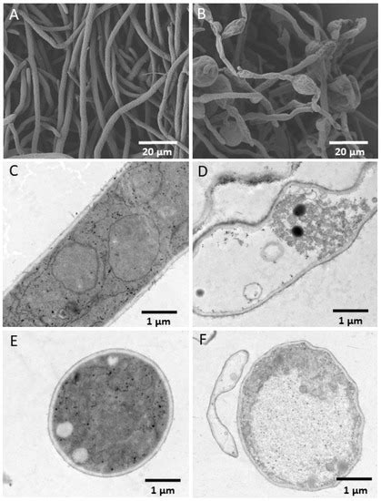 Response of Fusarium pseudograminearum to Biocontrol Agent Bacillus ...