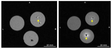 PRIMERS: Polydopamine Radioimmunotherapy with Image-Guided Monitoring ...
