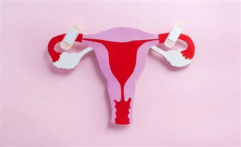 PCI Treatment 的图像结果