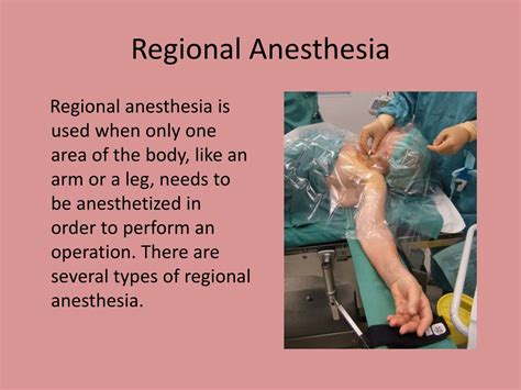 Different Types Of Anesthesia For Surgery at Annalisa Hanley blog