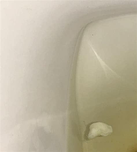 Mucus plug? | BabyCenter