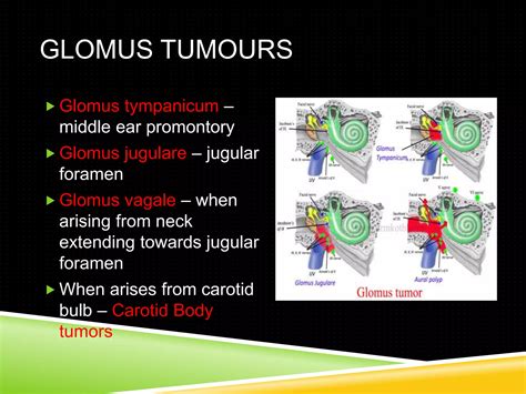 Glomus tumors | PPTX