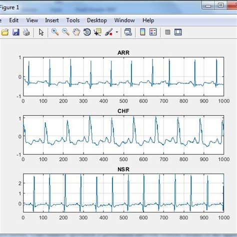 ECG Classification Using Machine Learning 的图像结果