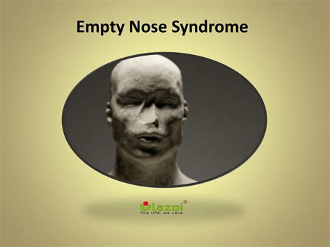 PPT - Empty Nose Syndrome PowerPoint Presentation, free download - ID ...