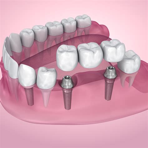 Home - Smart Dental Network