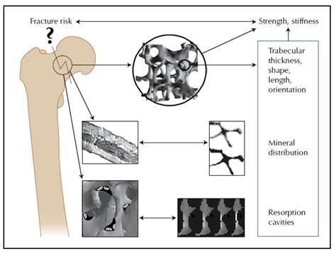 Bioactive Glass and Glass-Ceramic Scaffolds for Bone Tissue Engineering