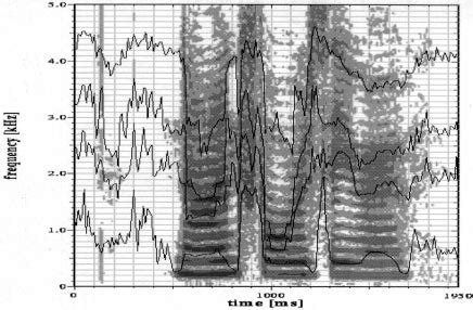 Spectrogram Based Formant Extraction 的图像结果