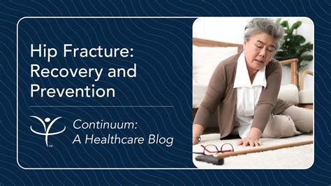 Hip Fracture: Recovery and Prevention | Vibra Healthcare