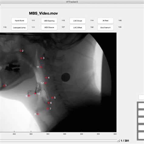 How to Use MATLAB Point Tracker 的图像结果