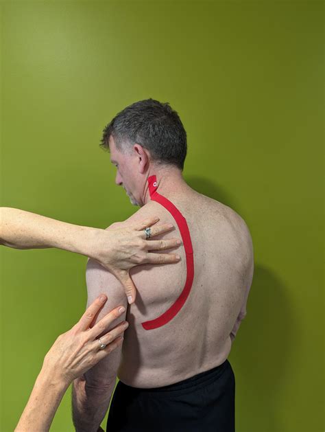 Treatment Of Dorsal Scapular Nerve Entrapment