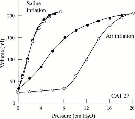 Elastic pressure–volume curves: what information do they convey? | Thorax