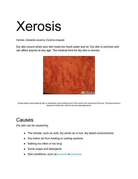 Medical Terminology Xerosis at Aidan Whyte blog