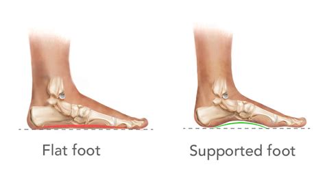 Buy Footlogics Premium Online in India