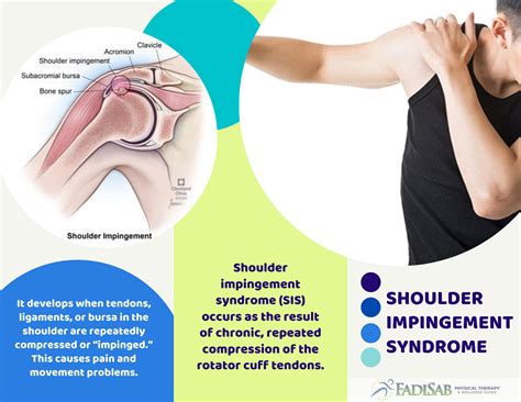 Back Pain and How To Treat It | FadiSab Clinic