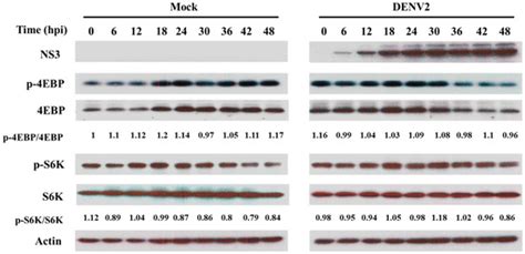 PERK Signal-Modulated Protein Translation Promotes the Survivability of ...
