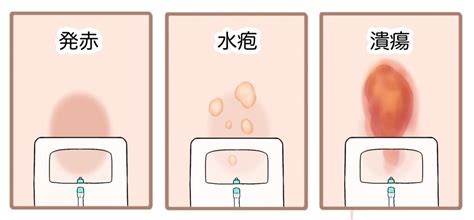 String Operator JavaScript 的图像结果