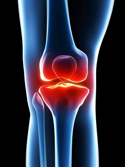 Knee Pain and How to relieve it effectively? | ACC