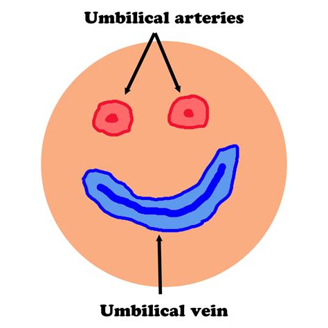Procedure: Umbilical Vein Catheterization - First10EM