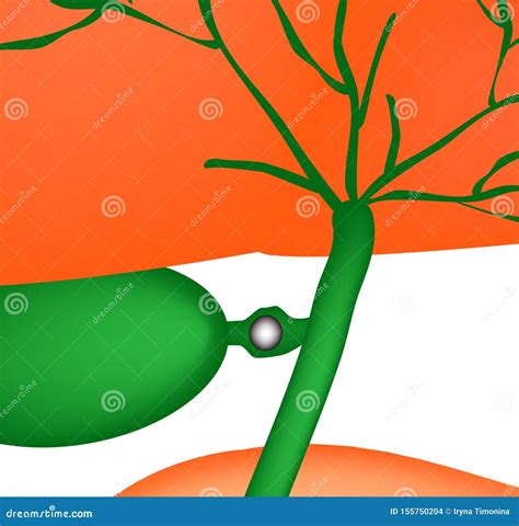 Gallbladder And Bile Duct Mayo Clinic