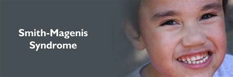 Smith-Magenis Syndrome: Causes, Symptoms & Treatment