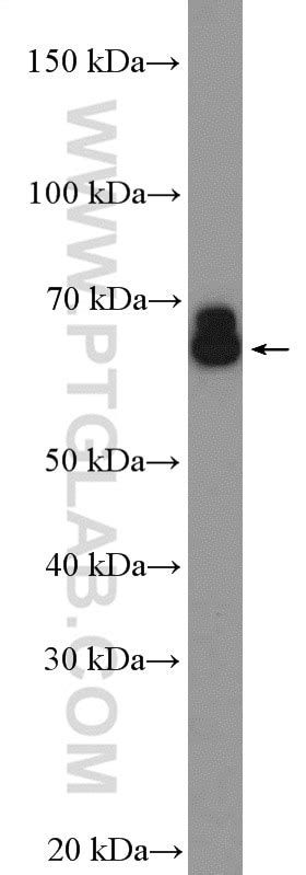 PDILT antibody (26305-1-AP) | Proteintech