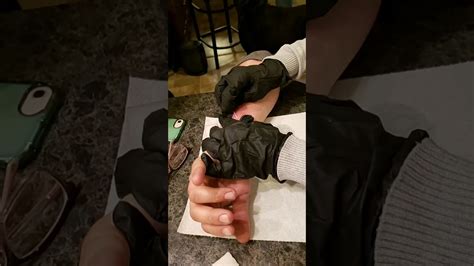 Image result for Loud Exploding Zit