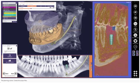 Exoplan Tutorial 的图像结果